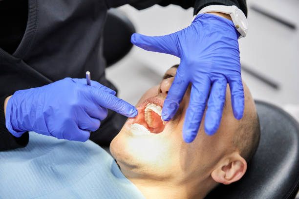 Best Walk-In Emergency Dentist in Canton, MO